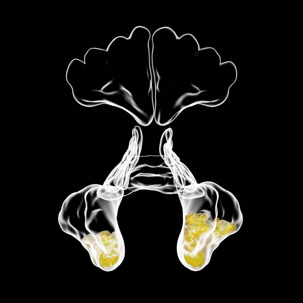 Синусит, запалення паранових порожнин. 3D-ілюстрація, що показує запалення махілярних синусів, також відомих як антрум Гаймора, вигляд зблизька. - Фото, зображення