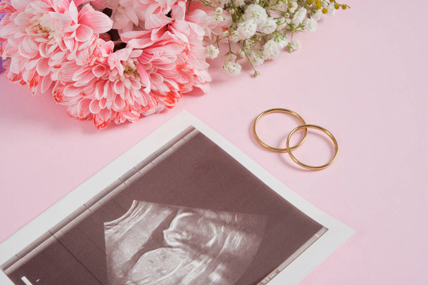 ultrasone foto, trouwringen en bloemen op een roze achtergrond zwangerschap en moederschap concept, bewust ouderschap, vreugde van het hebben van een kind in het gezin - Foto, afbeelding