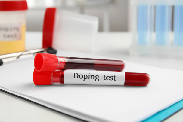 Test tubes with blood samples on white table. Doping control - Foto, afbeelding