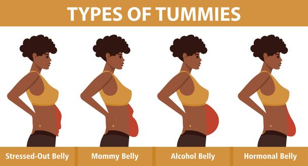 Four types of Tummies for African American women. Overweight woman side view. Problem areas on the stomach. Vector illustration isolated on white background. - Vector, Image