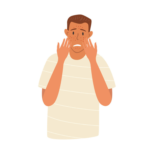 Flat vector cartoon illustration of a young sad boy with skin problems covering her face with her hands. Red rashes, pimples on the face. White background. - Vector, Image