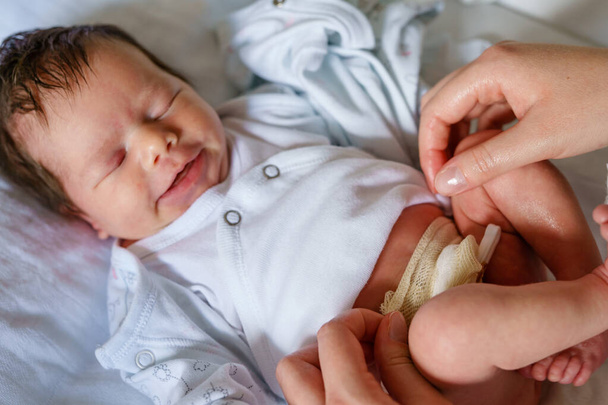 Руки невідомої жінки мати доглядає за пупковим шнуром з затискачем новонародженого немовляти неонатальний догляд батьків чистий пупок дитини на ліжку вдома
 - Фото, зображення