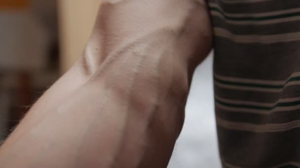 Swollen Veins Closeup - Filmmaterial, Video