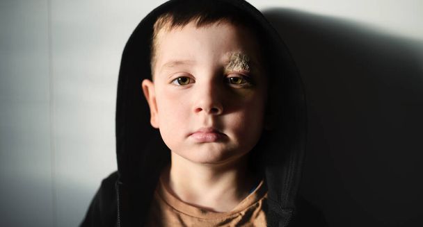 Pauvre petit garçon triste avec les sourcils coupés debout à l'intérieur à la maison, concept de pauvreté. - Photo, image