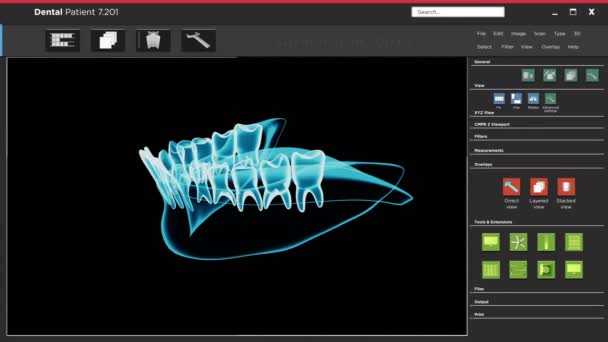 Interface da interface de usuário do aplicativo de software com varredura de raio-x dental , - Filmagem, Vídeo