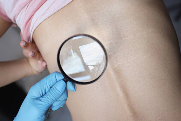 Arzt untersucht Wirbelsäulenprobleme des Patienten durch Lupe - Foto, Bild