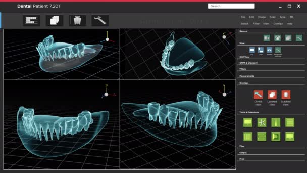 Ludzki ząb rentgenowski i oprogramowanie do skanowania - Materiał filmowy, wideo