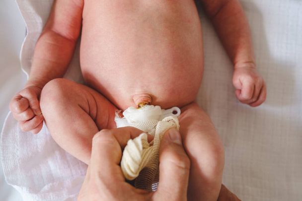 Руки невідомого чоловіка батько піклується про пуповинний шнур з затискачем і пов'язкою новонародженої дитини неонатальної допомоги батько чистий пупок дитини на ліжку вдома
 - Фото, зображення