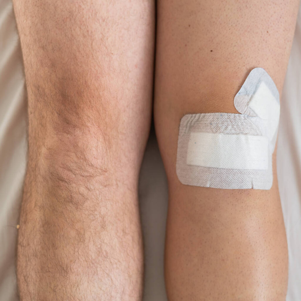 Close-up of male legs with knee taped with tape after laparoscopic minisk surgery - Фото, зображення