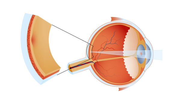 Eye Ball Structure. Modern Flat Vector Illustration. Detailed Anatomy of the Healthy Eye and Focal Point. Website Banner. Social Media Template.  - Vector, Image