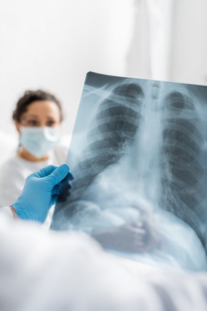 radiologista em luva de látex segurando pulmões raio-x perto de mulher afro-americana em máscara médica em fundo borrado - Foto, Imagem