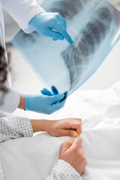 vista parcial del radiólogo en guantes de látex apuntando a la radiografía de los pulmones cerca del paciente en primer plano borroso - Foto, imagen
