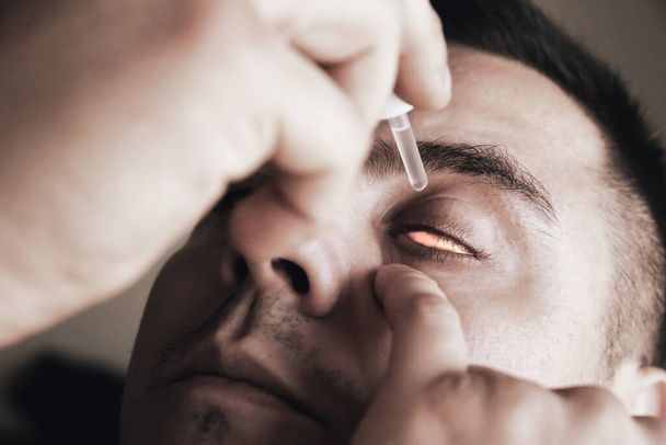 Az ember cseppeket ad a szemébe. Orvosi kezelési koncepció. Allergiás kötőhártya-gyulladás. - Fotó, kép