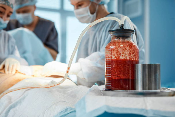 αισθητική λιποαναρρόφηση χειρουργική επέμβαση σε πραγματικό χώρο χειρουργείου δείχνει την ομάδα χειρουργών κατά τη διάρκεια της επέμβασης - Φωτογραφία, εικόνα