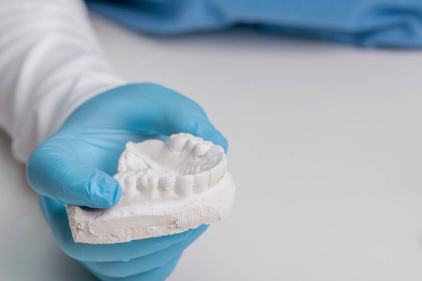 dentista médico sostiene un molde de dientes en sus manos para hacer frenos invisibles contra el bruxismo, primer plano - Foto, Imagen