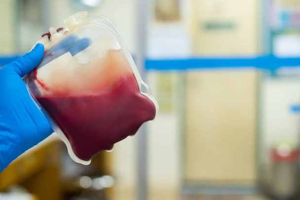 Χέρι επιστήμονας σε μπλε γάντι με το αίμα τσάντα δότη crossmatcing έννοια. - Φωτογραφία, εικόνα