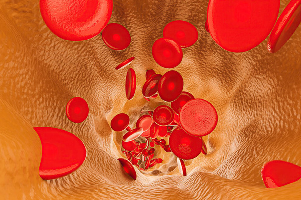 egy véna belseje tele koleszterinnel, benne vörösvértestekkel. 3D-s renderelés - Fotó, kép