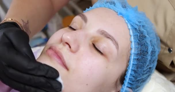 Kozmetológus orvos törölje nő arcát használ pamut párna után hámozási eljárás. Az orvos kozmetikai beavatkozást végez a kozmetikai klinikán. Törődj az arcbőrrel - Felvétel, videó