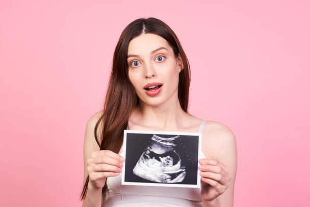 Pregnant young woman with her child sonography. Surprised mom-to-be, enjoying the first photo of her unborn child, anticipating her future life, pink studio background. - Photo, image
