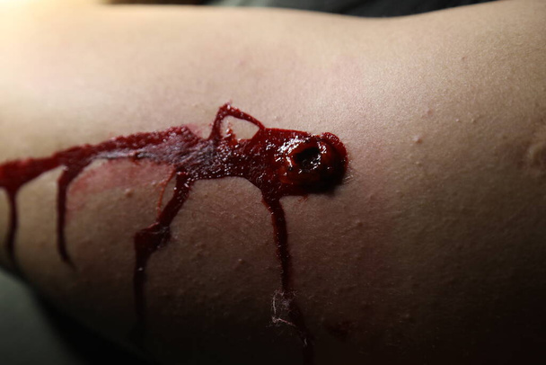 Herida de bala en una mano - Foto, Imagen
