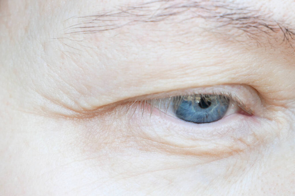 Ojo de mujer de mediana edad con párpado caído. La ptosis es una caída del párpado superior, ojo perezoso. Cosmetología y concepto facial, primeras arrugas, primer plano - Foto, Imagen