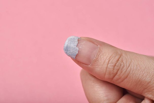 Clou cassé fissuré, ongles fragilisés par le gel vernis, hygiène de la manucure Fingernail. - Photo, image
