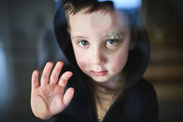 Poor sad small boy with cut eyebrow standing indoors at home, poverty concept. - Foto, Bild