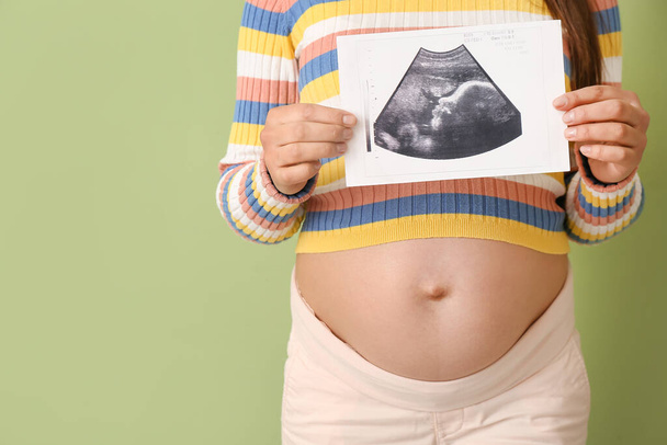 jong zwanger vrouw met echo afbeelding op kleur achtergrond - Foto, afbeelding