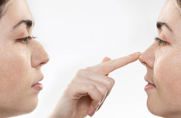 鼻形成術。鼻形成前と後の結果を示す2人の女性の顔をクローズアップ.鼻の先に手の人差し指。サイドビュー。白地だ。審美的な手術の概念 - 写真・画像