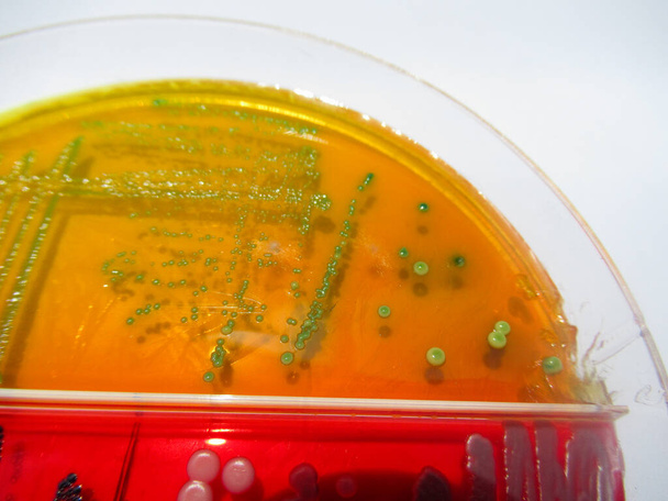 寒天培地で栽培された細菌コロニーのクローズアップ写真です - 写真・画像