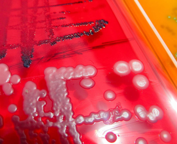 closeup photo of bacterial colonies grown on agar media - Photo, Image