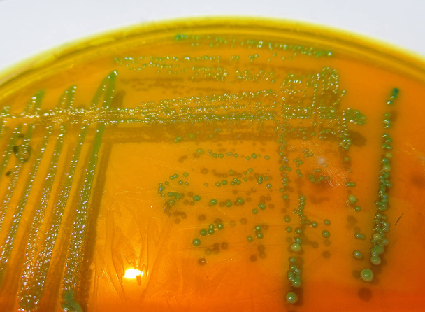 közeli kép bakteriális telepek termesztett agar média - Fotó, kép