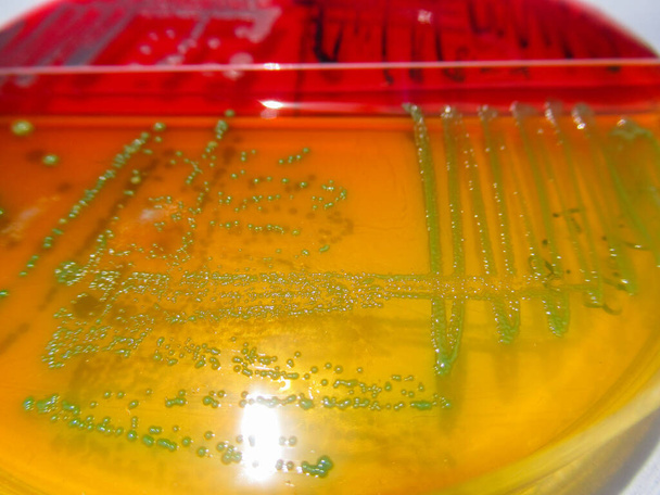 寒天培地で栽培された細菌コロニーのクローズアップ写真です - 写真・画像