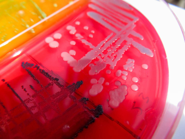 крупним планом фото бактеріальних колоній, вирощених на агарах
 - Фото, зображення