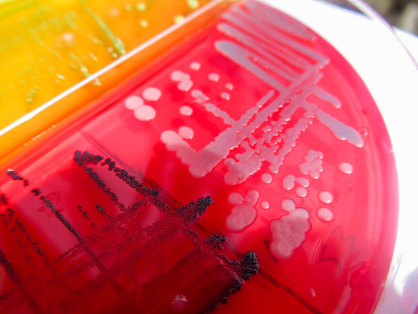 foto de primer plano de colonias bacterianas cultivadas en medios de agar - Foto, Imagen