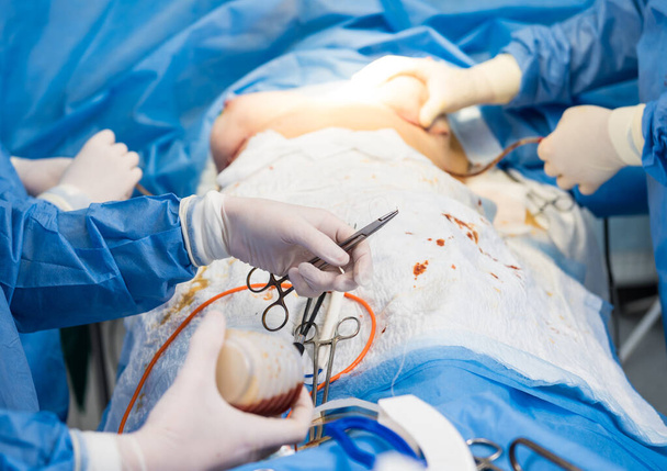 Breast augmentation under the guidance surgeons team in surgical operating room. - Zdjęcie, obraz