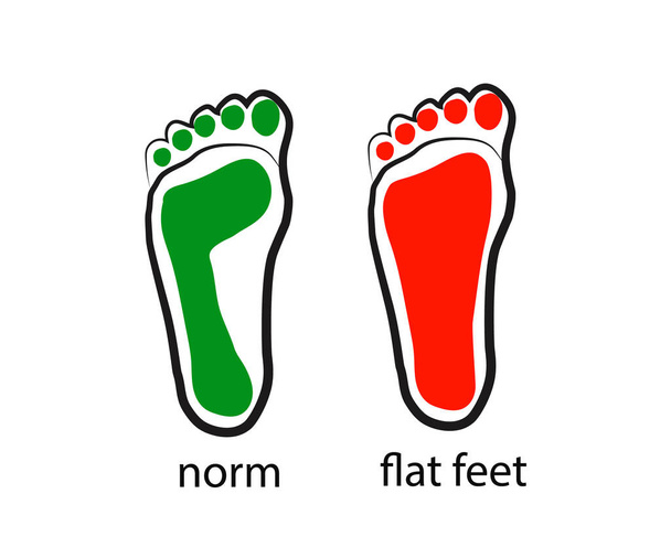 Emberi lábnyom. Lapos lábak. Szimbólum. Vektorillusztráció. - Vektor, kép