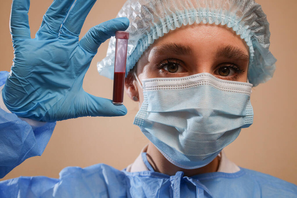Uma enfermeira detém um tubo de ensaio com uma amostra de sangue positiva para o coronavírus de Wuhan, China. pandemia de 2019 nCoV. Parar coronavírus. MERS. Um virologista está a pensar numa vacina contra o coronavírus. gripe, gripe aviária - Foto, Imagem