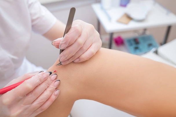 Close-up of electro epilation on the leg. The doctor removes unwanted hair from the patient with an electric device and tweezers - Foto, imagen