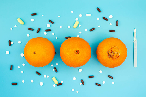 Oranges avec un gros nombril, pilules, scalpel sur fond bleu. concept de traitement médical ou chirurgical des hémorroïdes - Photo, image