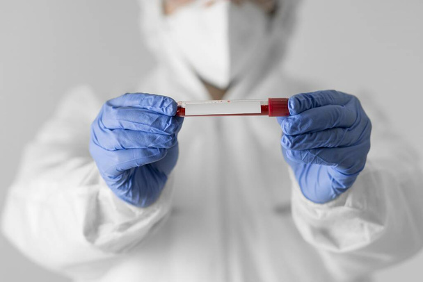 close up médecin tenant un échantillon de sang. Résolution et belle photo de haute qualité - Photo, image