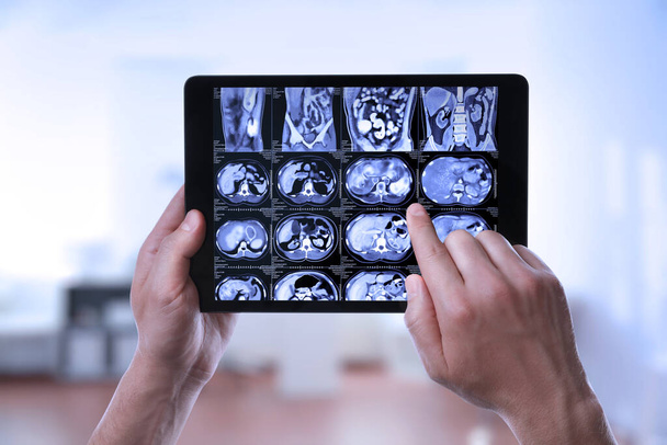 Arzt untersucht Röntgenbilder auf Tablet in geschlossenen Räumen, Nahaufnahme - Foto, Bild