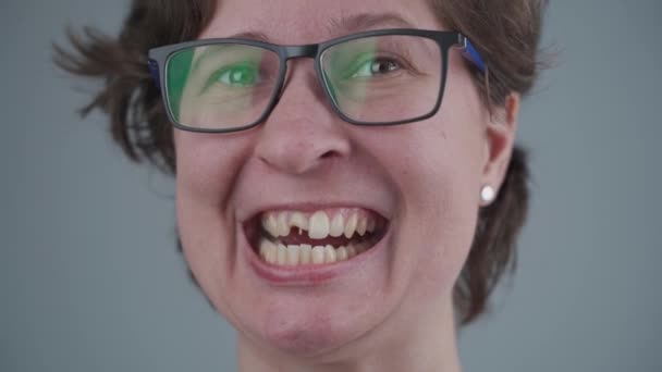 Jeune femme caucasienne souriante avec dent avant cassée d'où ressortent les épingles en fibre de verre. Blessure à la dent, fracture de la moitié des dents après un accident. Dentisterie et traitement maxillofacial. Traumatisme dentaire - Séquence, vidéo
