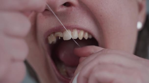Famale with bad teeth changed her mind late and uses dental floss, but too late her teeth are damaged. Woman with damaged front tooth makes oral hygiene on gray background. Healthcare - Footage, Video