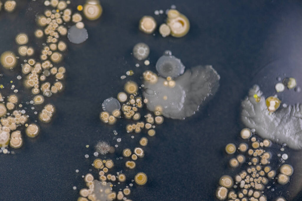 微生物学研究室での教育のための土壌試料からの寒天プレート上に成長する細菌とカビの異なる形のコロニーの特徴と背景. - 写真・画像