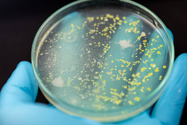 Antecedentes de características y diferentes formas de colonia de bacterias y moho que crece en placas de agar de muestras de suelo para la educación en el laboratorio de microbiología. - Foto, imagen