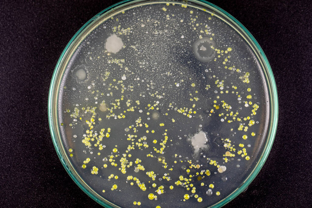 Tła charakterystyczne i różnokształtna kolonia bakterii i pleśni rosnąca na płytkach agaru z próbek gleby przeznaczonych do edukacji w laboratorium mikrobiologicznym. - Zdjęcie, obraz