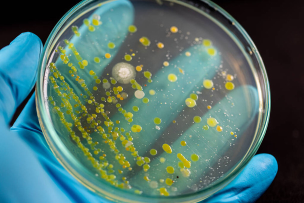 Východiska charakteristik a různě tvarovaná kolonie bakterií a plísní rostoucí na agarových deskách ze vzorků půdy pro výuku v mikrobiologické laboratoři. - Fotografie, Obrázek