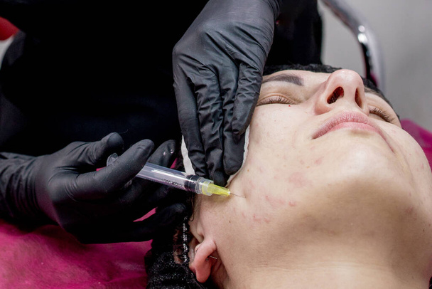 Face mesotherapy procedure in a beauty salon. Beautician doctor makes injections into the skin of the face of woman.Mesotherapy, biorevitalization.Close-up. Selective focus - Foto, afbeelding