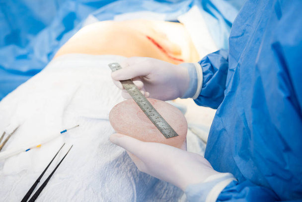 Breast augmentation under the guidance surgeons team in surgical operating room. - Valokuva, kuva